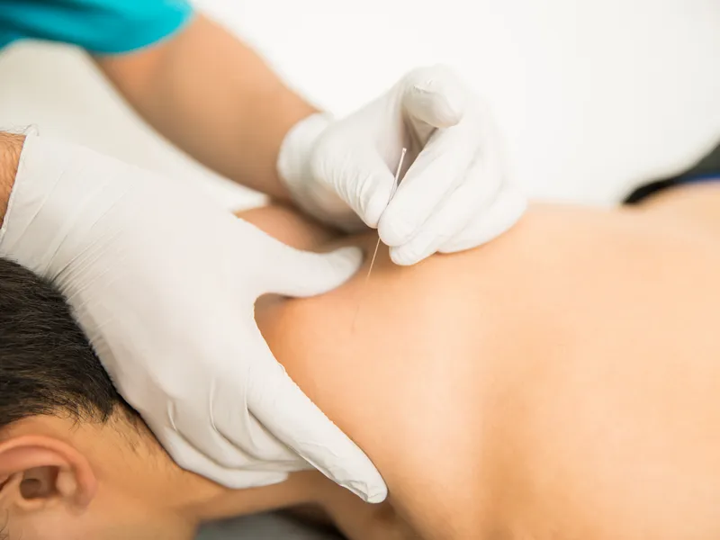Dry Needling at Bluebonnet Chiropractic in Tomball