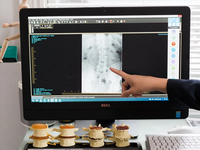 How X-Rays works at Bluebonnet Chiropractic
