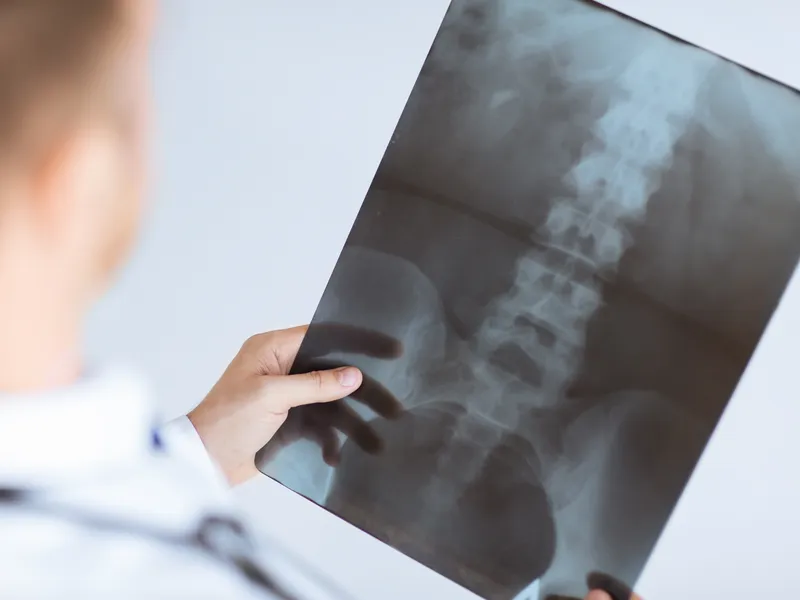 X-Rays at Bluebonnet Chiropractic in Tomball